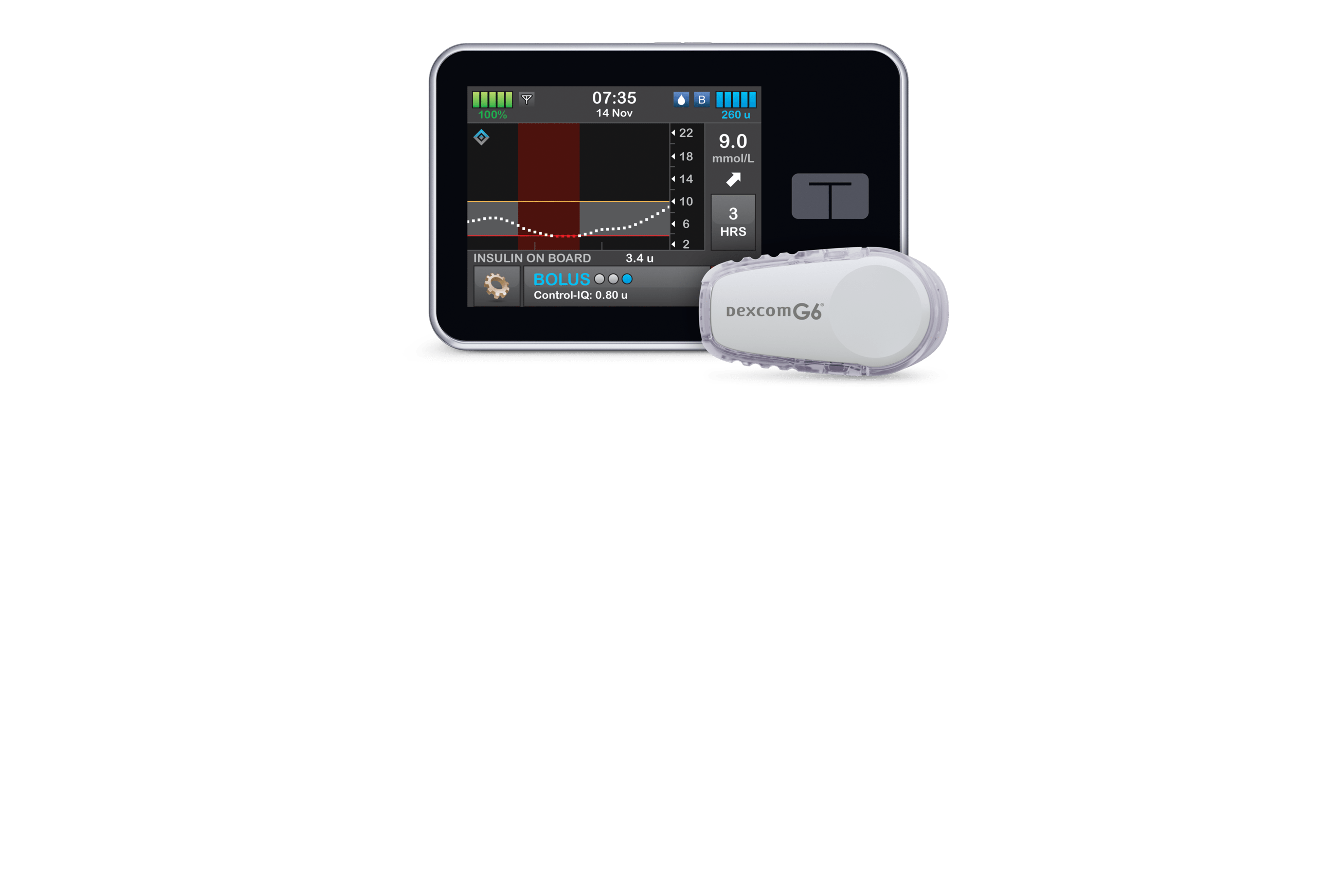 tslim X2™ Insulin Pump with ControlIQ™ Technology Insulin Pump Australia