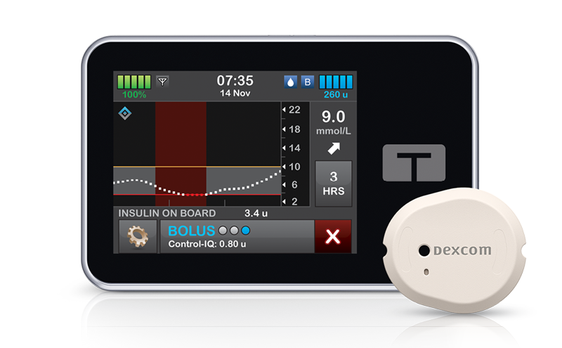 t:slim Control-IQ and the all-in-one Dexcom CGM sensor