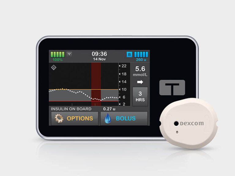 Tandem t:slim Control-IQ technology with Dexcom G7