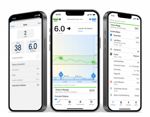 Mobile bolus with the Tandem t:slim mobile app