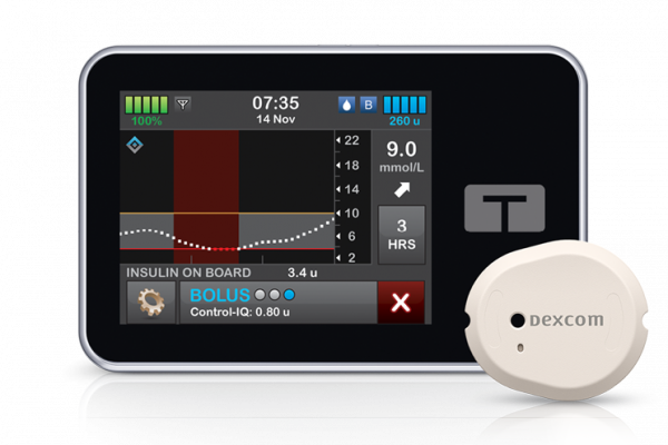 t:slim Control-IQ and the all-in-one Dexcom CGM sensor